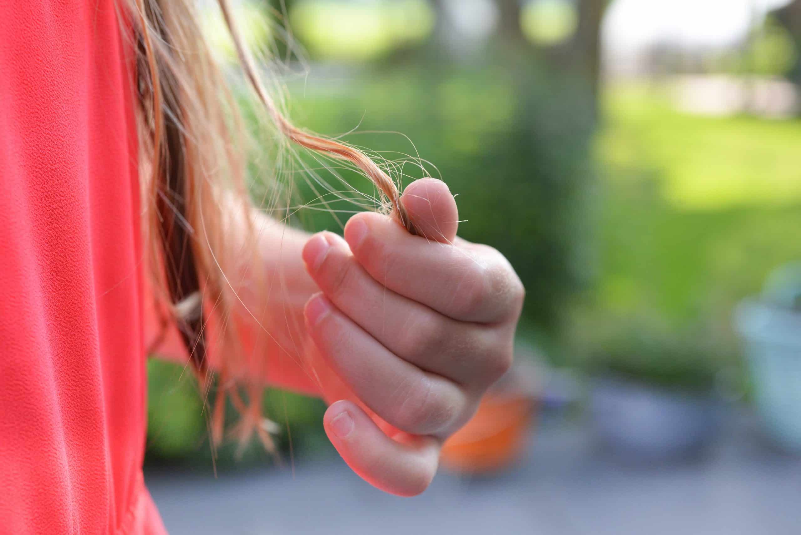 Alopecia – ved du, hvad det er?